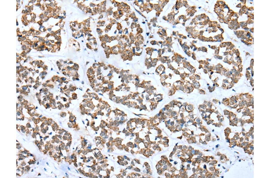 Immunohistochemistry - FSD1L Antibody from Signalway Antibody (43362) - Antibodies.com