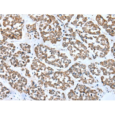 Immunohistochemistry - FSD1L Antibody from Signalway Antibody (43362) - Antibodies.com
