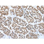 Immunohistochemistry - FSD1L Antibody from Signalway Antibody (43362) - Antibodies.com