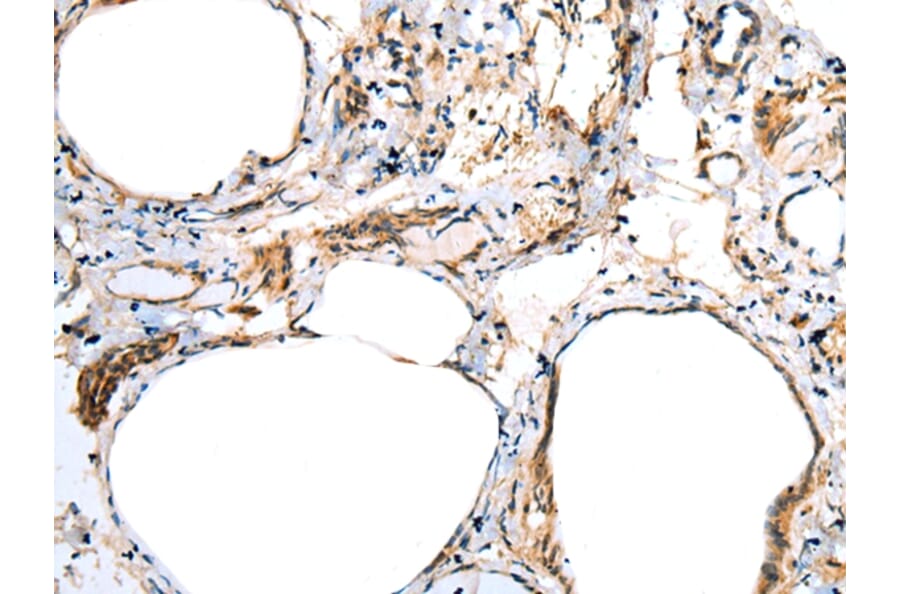 Immunohistochemistry - FSD1L Antibody from Signalway Antibody (43362) - Antibodies.com