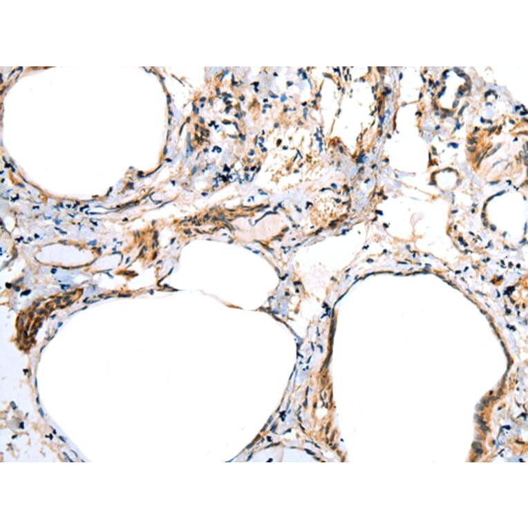 Immunohistochemistry - FSD1L Antibody from Signalway Antibody (43362) - Antibodies.com