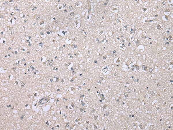 Immunohistochemical analysis of paraffin-embedded Human brain tissue using #43364 at dilution 1/25,