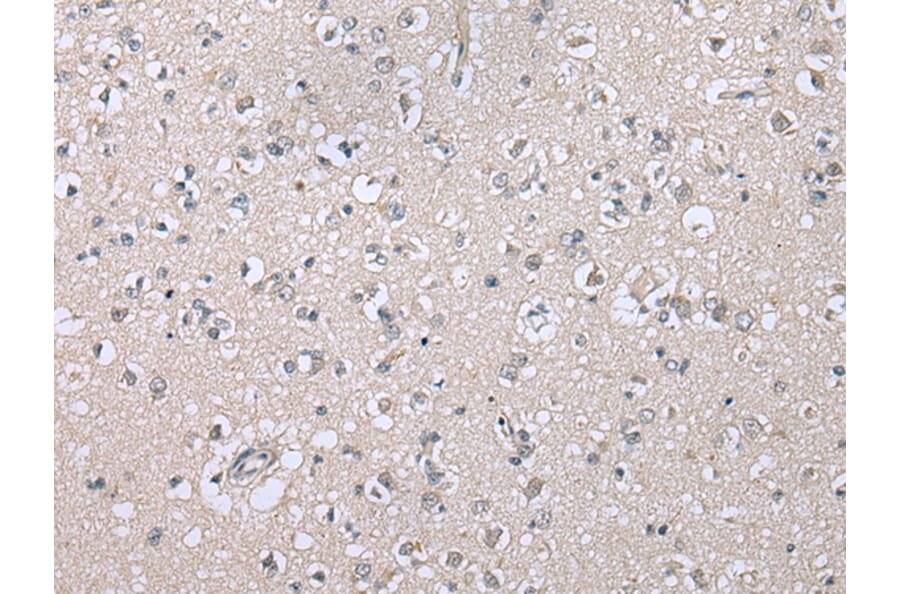 Immunohistochemistry - CDHR4 Antibody from Signalway Antibody (43364) - Antibodies.com