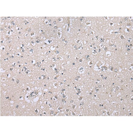 Immunohistochemistry - CDHR4 Antibody from Signalway Antibody (43364) - Antibodies.com