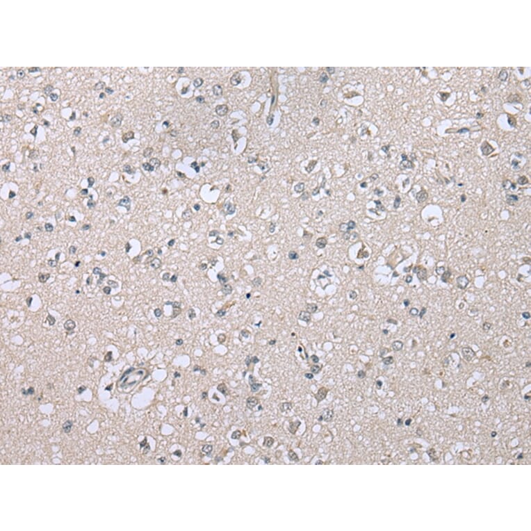 Immunohistochemistry - CDHR4 Antibody from Signalway Antibody (43364) - Antibodies.com