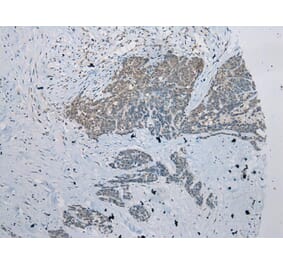 Immunohistochemistry - ZNRD1 Antibody from Signalway Antibody (43369) - Antibodies.com