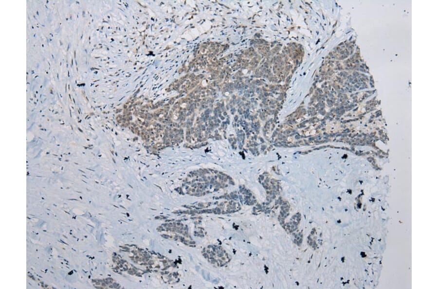 Immunohistochemistry - ZNRD1 Antibody from Signalway Antibody (43369) - Antibodies.com