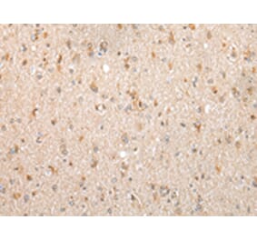 Immunohistochemistry - FKBP7 Antibody from Signalway Antibody (43387) - Antibodies.com