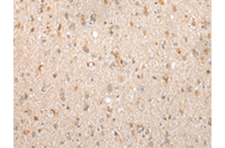 Immunohistochemistry - FKBP7 Antibody from Signalway Antibody (43387) - Antibodies.com