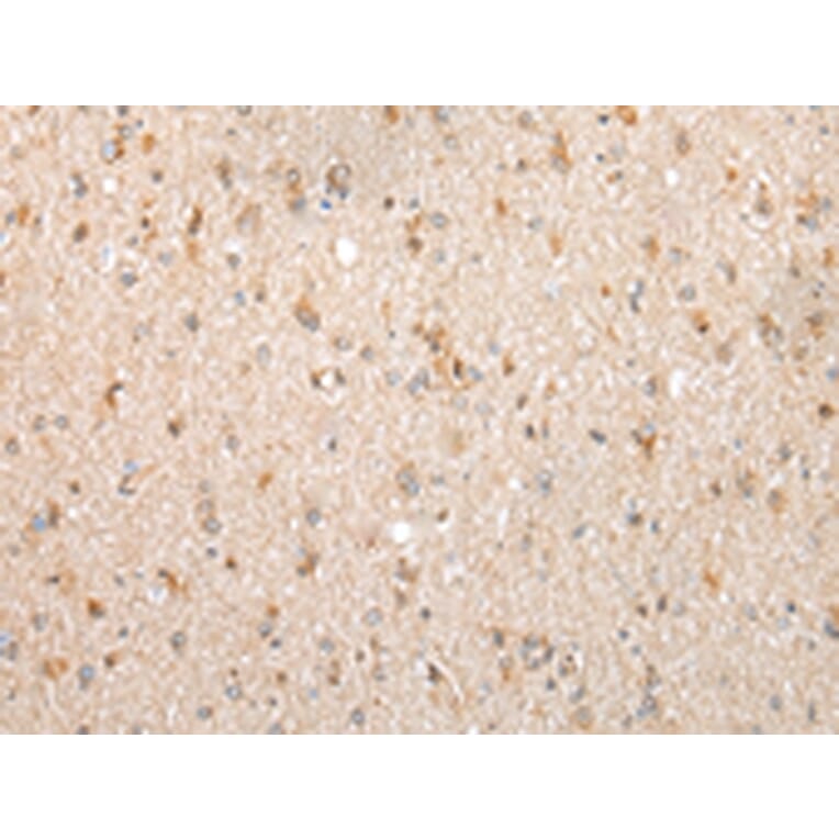 Immunohistochemistry - FKBP7 Antibody from Signalway Antibody (43387) - Antibodies.com