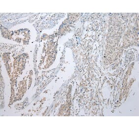 Immunohistochemistry - UBE2U Antibody from Signalway Antibody (43389) - Antibodies.com