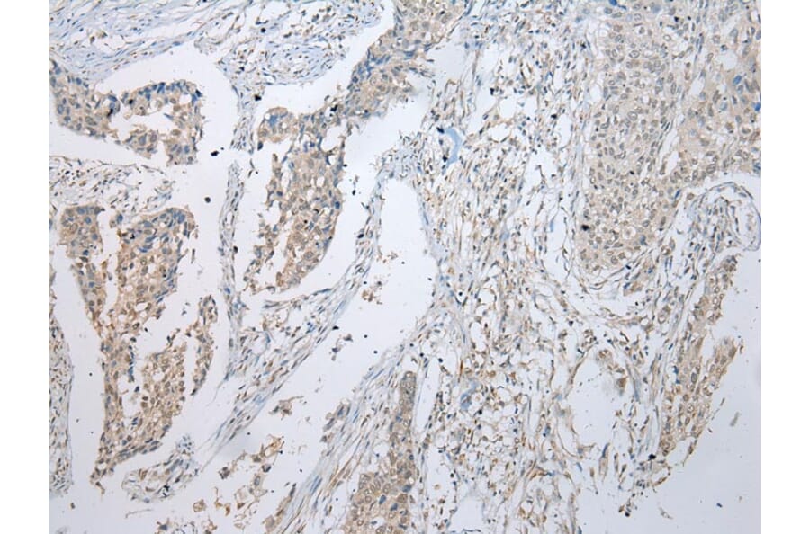 Immunohistochemistry - UBE2U Antibody from Signalway Antibody (43389) - Antibodies.com