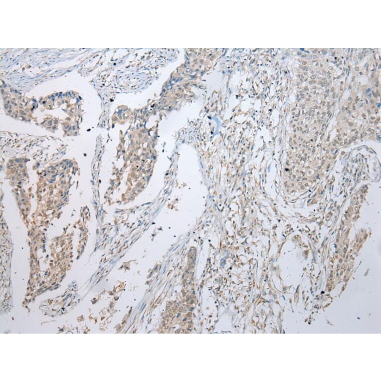 Immunohistochemistry - UBE2U Antibody from Signalway Antibody (43389) - Antibodies.com