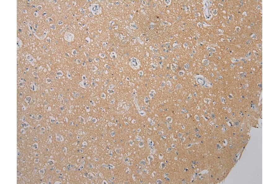 Immunohistochemistry - FOXN2 Antibody from Signalway Antibody (43397) - Antibodies.com