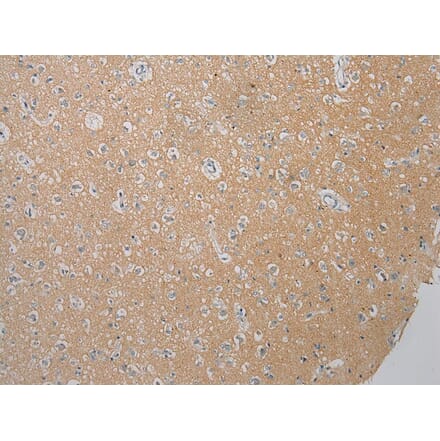 Immunohistochemistry - FOXN2 Antibody from Signalway Antibody (43397) - Antibodies.com