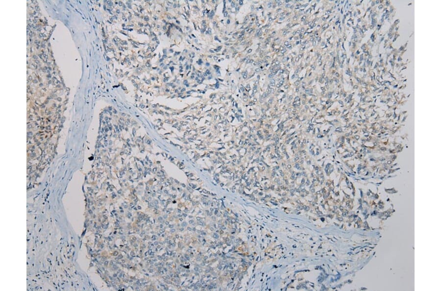 Immunohistochemistry - FOXN2 Antibody from Signalway Antibody (43397) - Antibodies.com