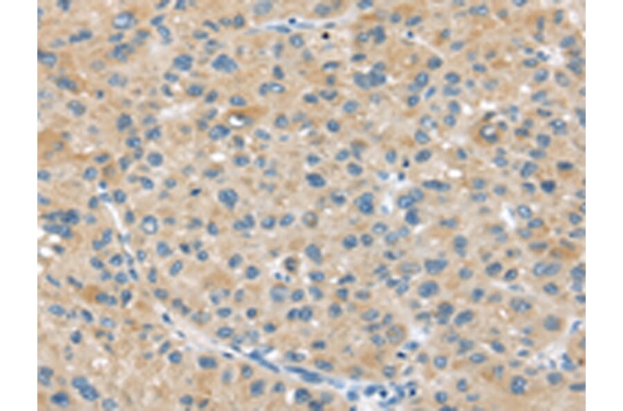 Immunohistochemistry - ABCC2 Antibody from Signalway Antibody (43399) - Antibodies.com
