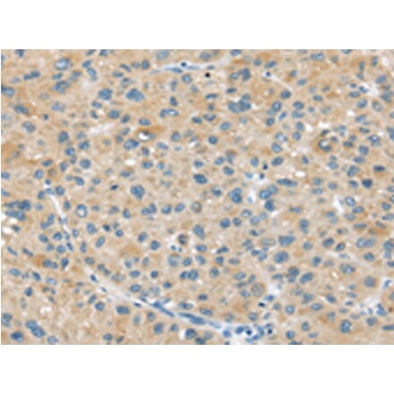 Immunohistochemistry - ABCC2 Antibody from Signalway Antibody (43399) - Antibodies.com