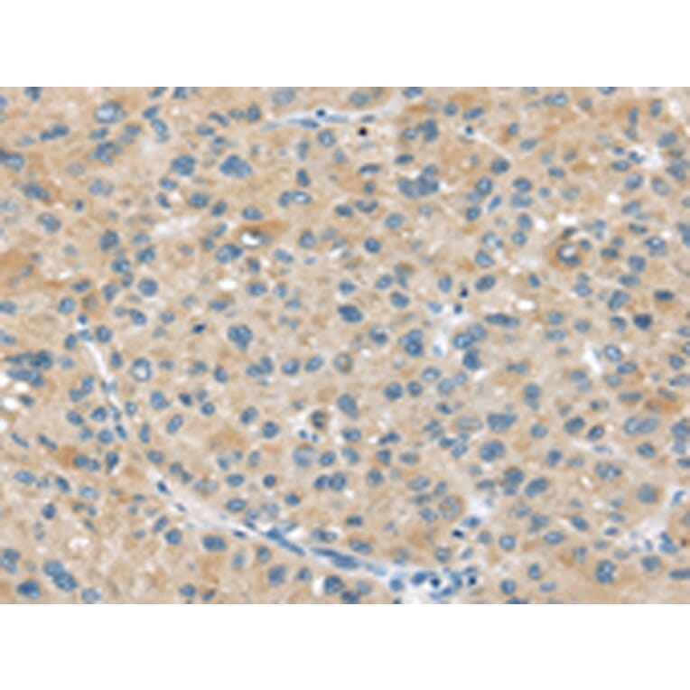 Immunohistochemistry - ABCC2 Antibody from Signalway Antibody (43399) - Antibodies.com