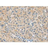 Immunohistochemistry - ABCC2 Antibody from Signalway Antibody (43399) - Antibodies.com