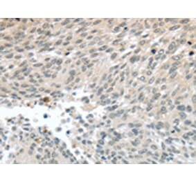 Immunohistochemistry - PALB2 Antibody from Signalway Antibody (43402) - Antibodies.com