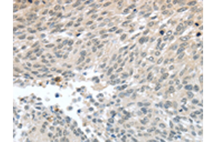 Immunohistochemistry - PALB2 Antibody from Signalway Antibody (43402) - Antibodies.com