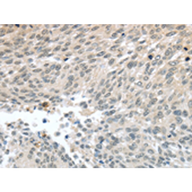 Immunohistochemistry - PALB2 Antibody from Signalway Antibody (43402) - Antibodies.com