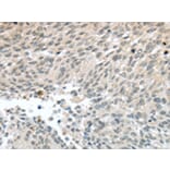 Immunohistochemistry - PALB2 Antibody from Signalway Antibody (43402) - Antibodies.com