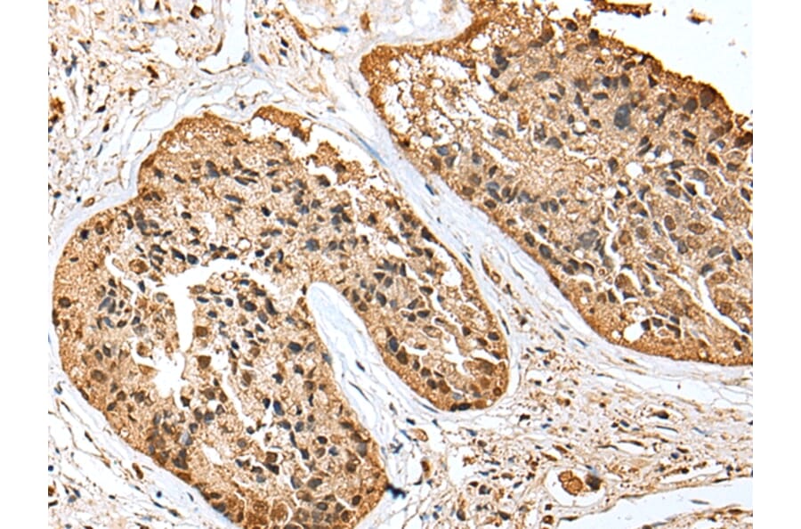 Immunohistochemistry - SCN1A Antibody from Signalway Antibody (43409) - Antibodies.com