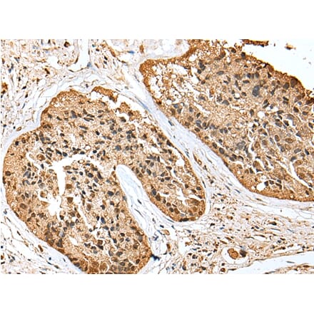 Immunohistochemistry - SCN1A Antibody from Signalway Antibody (43409) - Antibodies.com