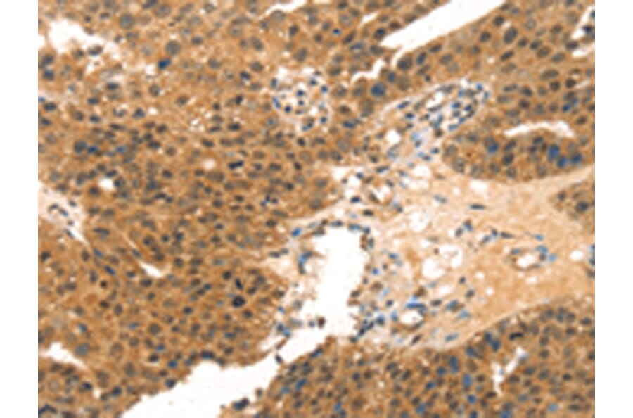 Immunohistochemistry - MED14 Antibody from Signalway Antibody (43427) - Antibodies.com