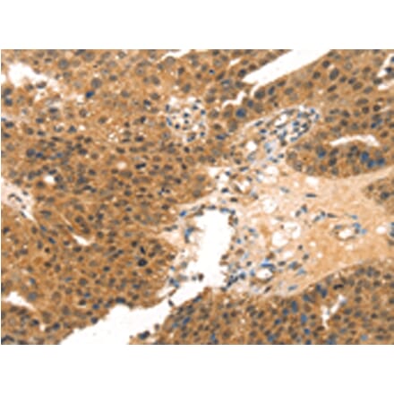Immunohistochemistry - MED14 Antibody from Signalway Antibody (43427) - Antibodies.com