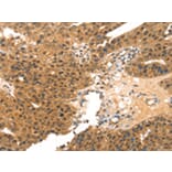 Immunohistochemistry - MED14 Antibody from Signalway Antibody (43427) - Antibodies.com