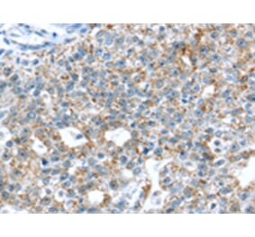 Immunohistochemistry - TTBK1 Antibody from Signalway Antibody (43428) - Antibodies.com