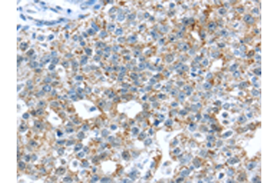 Immunohistochemistry - TTBK1 Antibody from Signalway Antibody (43428) - Antibodies.com