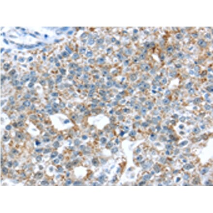 Immunohistochemistry - TTBK1 Antibody from Signalway Antibody (43428) - Antibodies.com