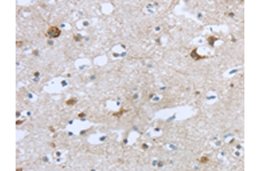 Immunohistochemistry - TTBK1 Antibody from Signalway Antibody (43428) - Antibodies.com
