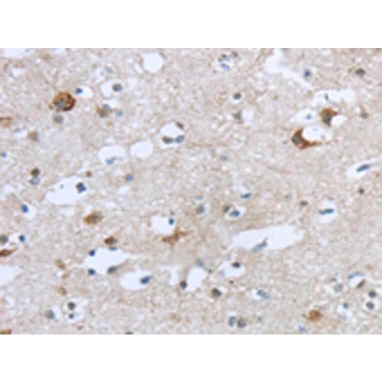 Immunohistochemistry - TTBK1 Antibody from Signalway Antibody (43428) - Antibodies.com