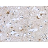 Immunohistochemistry - TTBK1 Antibody from Signalway Antibody (43428) - Antibodies.com