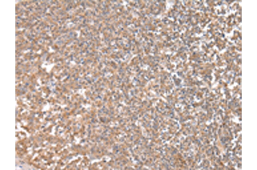 Immunohistochemistry - CPT1C Antibody from Signalway Antibody (43452) - Antibodies.com