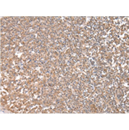 Immunohistochemistry - CPT1C Antibody from Signalway Antibody (43452) - Antibodies.com