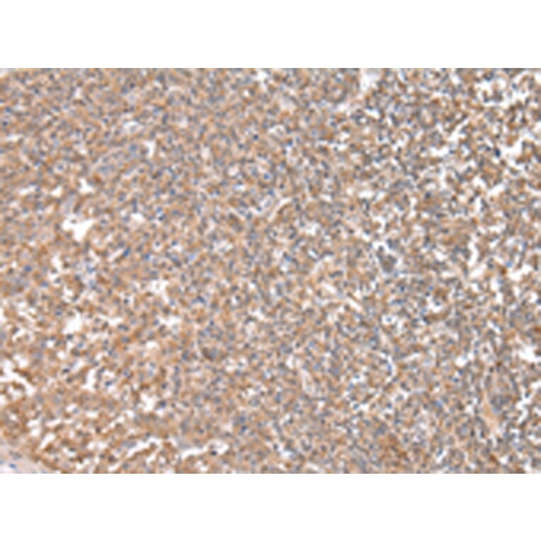 Immunohistochemistry - CPT1C Antibody from Signalway Antibody (43452) - Antibodies.com