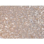 Immunohistochemistry - CPT1C Antibody from Signalway Antibody (43452) - Antibodies.com