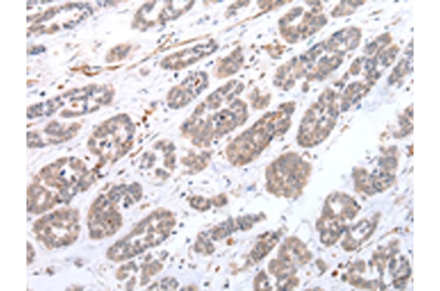 Immunohistochemistry - CPT1C Antibody from Signalway Antibody (43452) - Antibodies.com