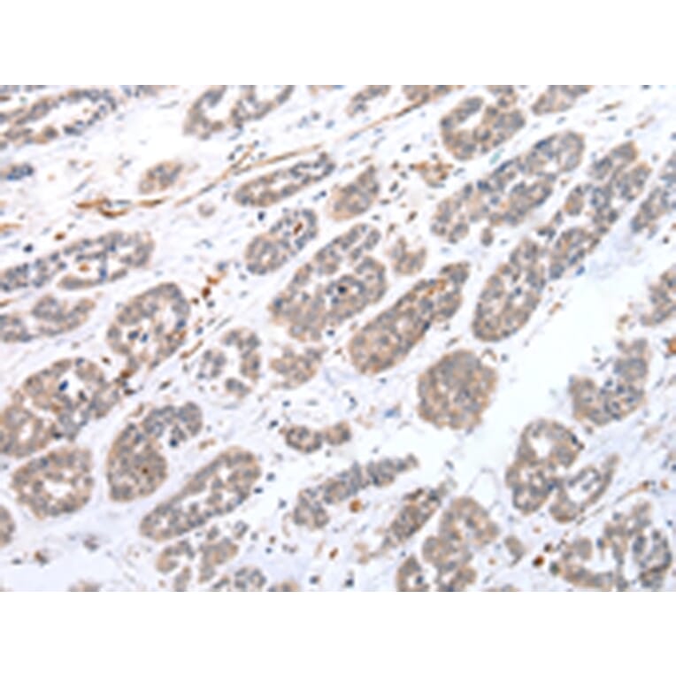 Immunohistochemistry - CPT1C Antibody from Signalway Antibody (43452) - Antibodies.com