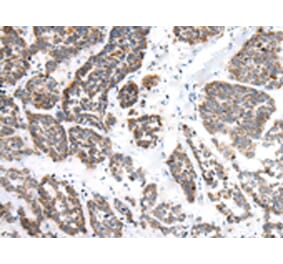 Immunohistochemistry - EPHB1 Antibody from Signalway Antibody (43459) - Antibodies.com