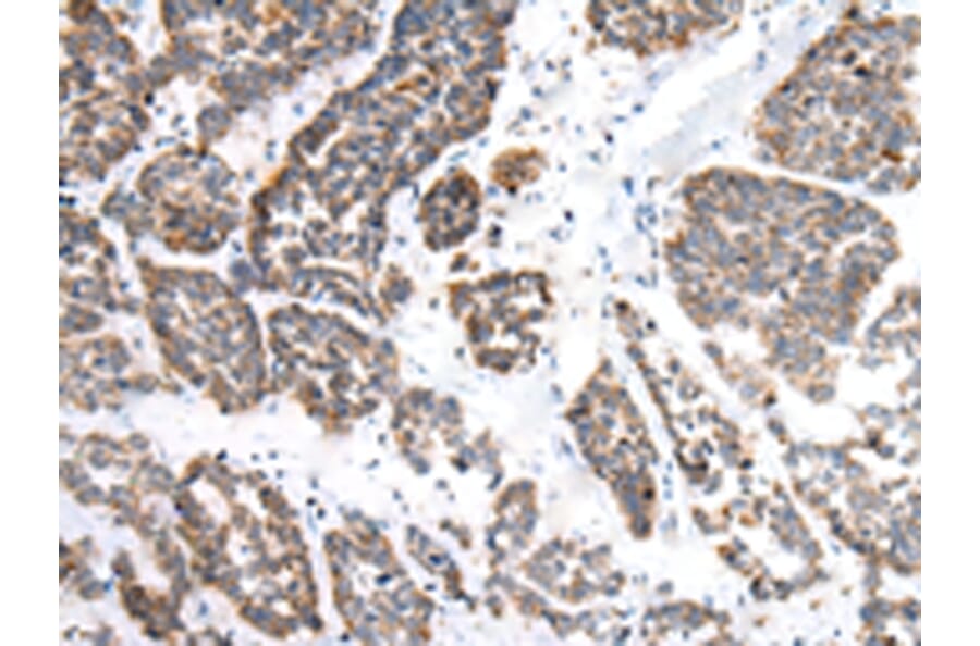 Immunohistochemistry - EPHB1 Antibody from Signalway Antibody (43459) - Antibodies.com