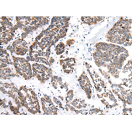 Immunohistochemistry - EPHB1 Antibody from Signalway Antibody (43459) - Antibodies.com