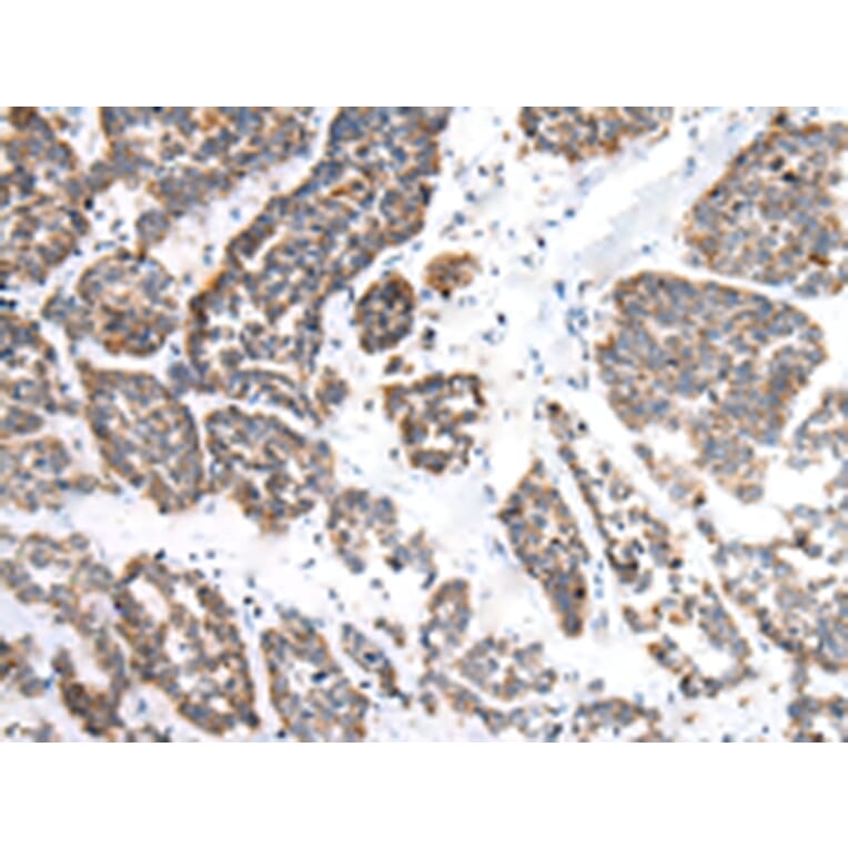 Immunohistochemistry - EPHB1 Antibody from Signalway Antibody (43459) - Antibodies.com