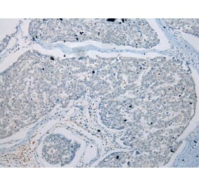 Immunohistochemistry - GDF10 Antibody from Signalway Antibody (43460) - Antibodies.com